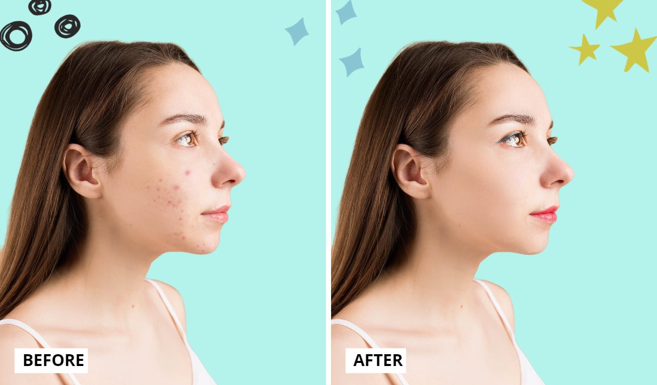 How to Retouch Portrait Photos and Remove Blemishes Learn BeFunky