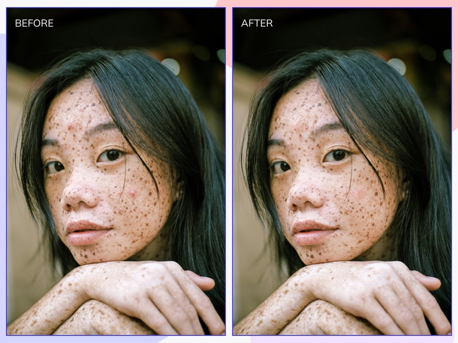 before and after photo of blemish remover tool